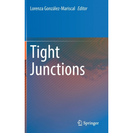 Tight Junctions