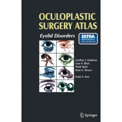 Oculoplastic Surgery Atlas: Eyelid Disorders
