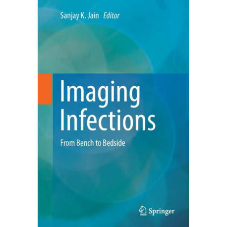 Imaging Infections: From Bench to Bedside