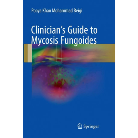 Clinician's Guide to Mycosis Fungoides