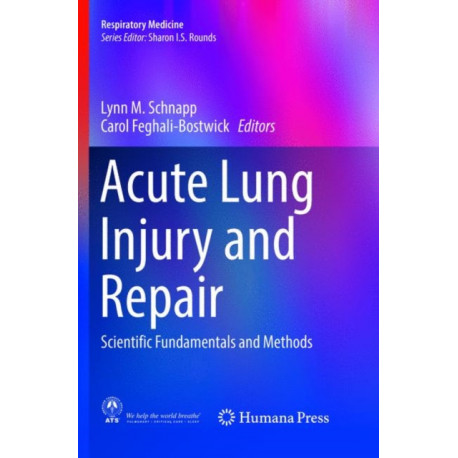 Acute Lung Injury and Repair: Scientific Fundamentals and Methods