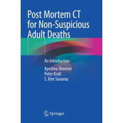 Post Mortem CT for Non-Suspicious Adult Deaths: An Introduction