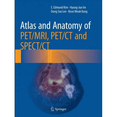 Atlas and Anatomy of PET/MRI, PET/CT and SPECT/CT