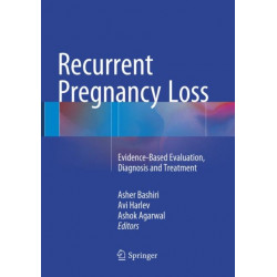 Recurrent Pregnancy Loss: Evidence-Based Evaluation, Diagnosis and Treatment
