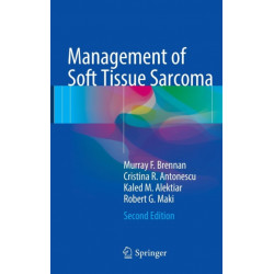 Management of Soft Tissue Sarcoma