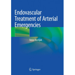 Endovascular Treatment of Arterial Emergencies
