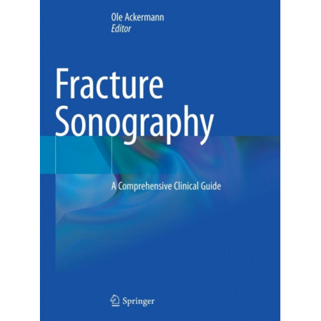 Fracture Sonography: A Comprehensive Clinical Guide