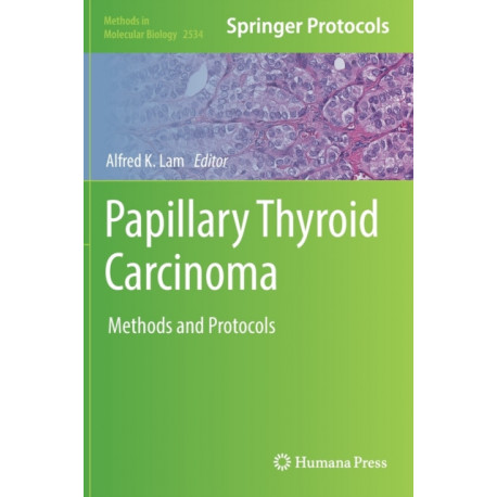 Papillary Thyroid Carcinoma: Methods and Protocols