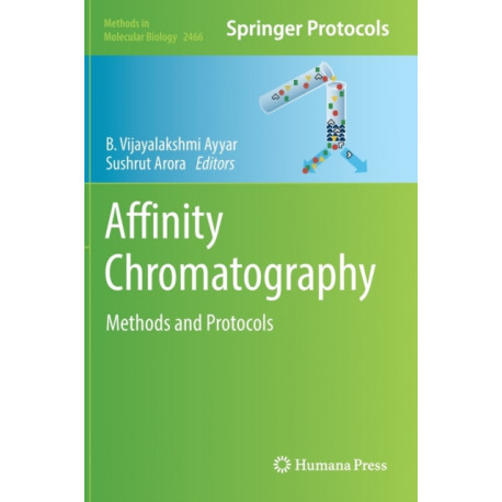 Affinity Chromatography: Methods and Protocols