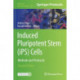 Induced Pluripotent Stem (iPS) Cells: Methods and Protocols
