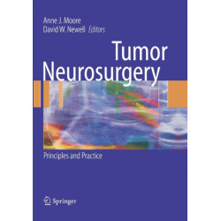 Tumor Neurosurgery: Principles and Practice