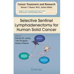 Selective Sentinel Lymphadenectomy for Human Solid Cancer