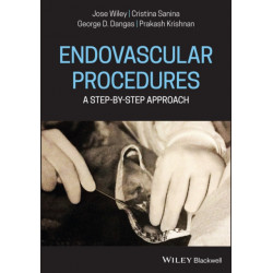 Endovascular Interventions: A Step-by-Step Approach