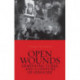 Open Wounds: Armenians, Turks, and a Century of Genocide