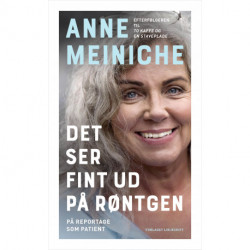 Det ser fint ud på røntgen: På reportage som patient