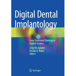 Digital Dental Implantology: From Treatment Planning to Guided Surgery