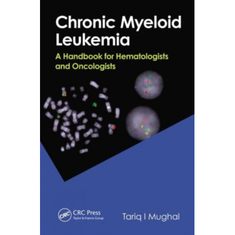 Chronic Myeloid Leukemia: A Handbook for Hematologists and Oncologists