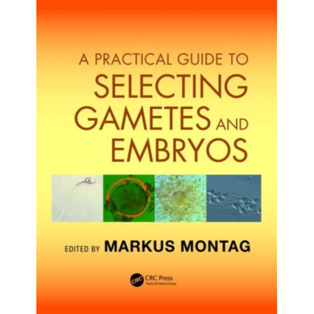 A Practical Guide to Selecting Gametes and Embryos