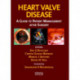 Heart Valve Disease: A Guide to Patient Management After Surgery