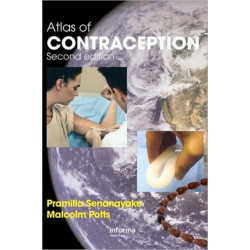 Atlas of Contraception