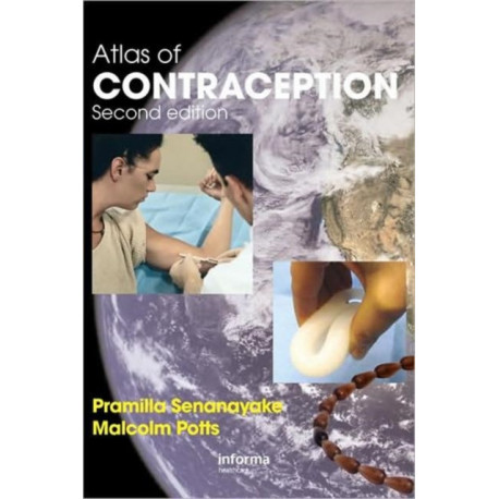 Atlas of Contraception