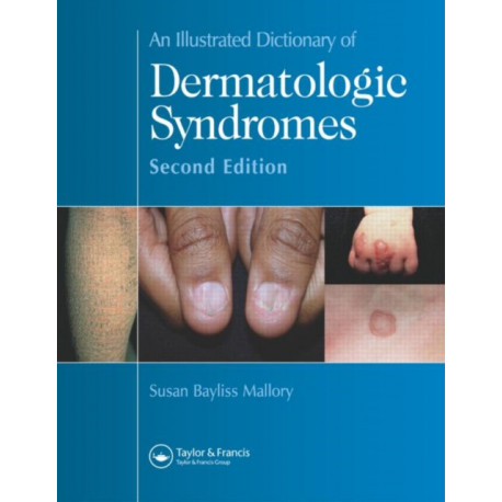 An Illustrated Dictionary of Dermatologic Syndromes