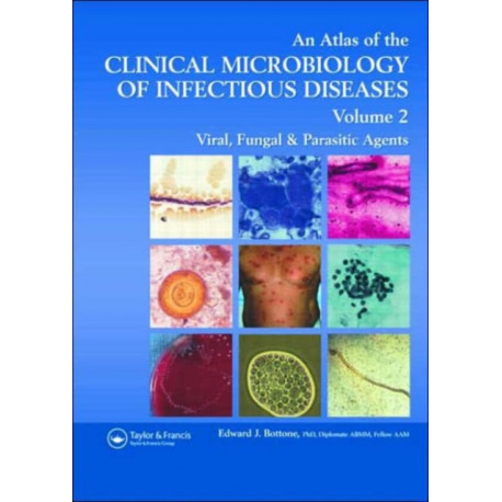 Atlas of the Clinical Microbiology of Infectious Diseases: Viral, Fungal and Parasitic Agents