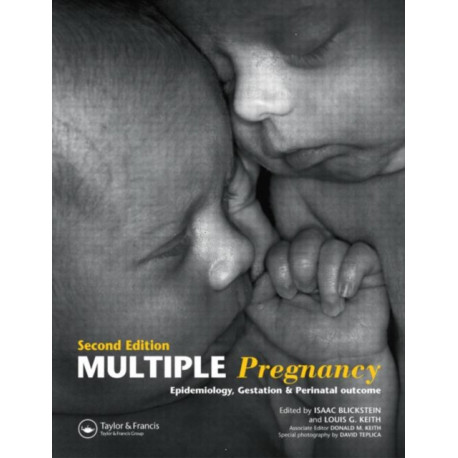 Multiple Pregnancy: Epidemiology, Gestation, and Perinatal Outcome