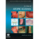 An Atlas of Atopic Eczema