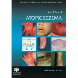 An Atlas of Atopic Eczema