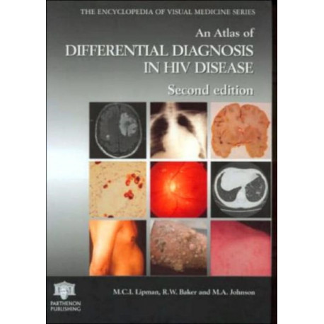 An Atlas of Differential Diagnosis in HIV Disease