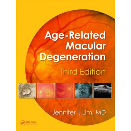 Age-Related Macular Degeneration, Third Edition