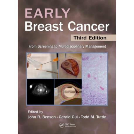 Early Breast Cancer: From Screening to Multidisciplinary Management, Third Edition
