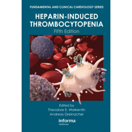 Heparin-Induced Thrombocytopenia
