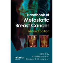 Handbook of Metastatic Breast Cancer