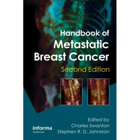 Handbook of Metastatic Breast Cancer