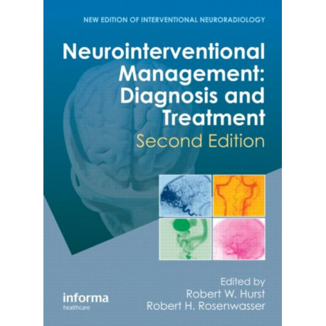 Neurointerventional Management: Diagnosis and Treatment