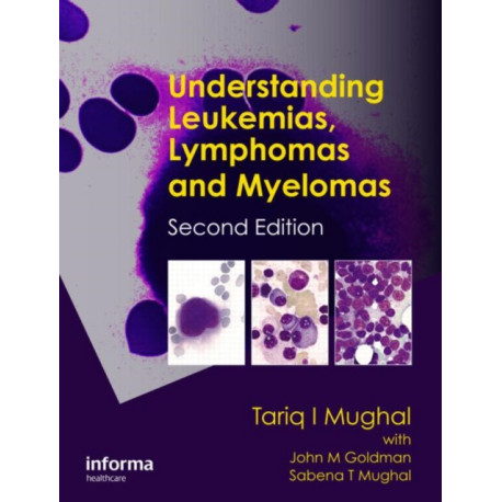 Understanding Leukemias, Lymphomas and Myelomas