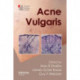 Acne Vulgaris