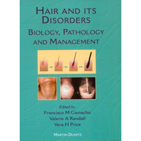 Hair and Its Disorders: Biology, Pathology and Management