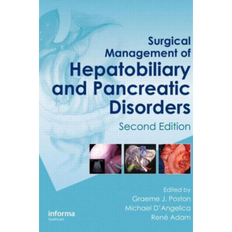 Surgical Management of Hepatobiliary and Pancreatic Disorders, Second Edition