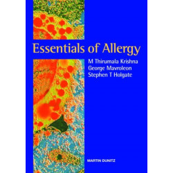 Essentials of Allergy