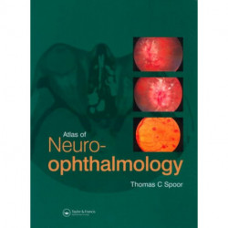 Atlas of Neuro-ophthalmology