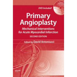 Primary Angioplasty: Mechanical Interventions for Acute Myocardial Infarction, Second Edition
