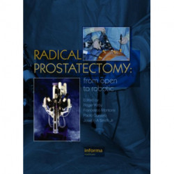 Radical Prostatectomy: From Open to Robotic