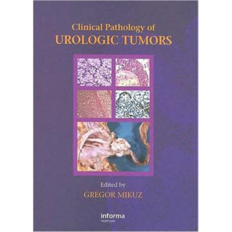 Clinical Pathology of Urological Tumours