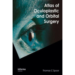 Atlas of Oculoplastic and Orbital Surgery