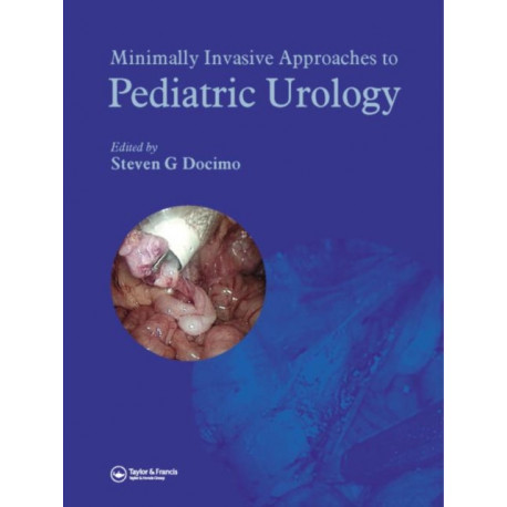 Minimally Invasive Approaches to Pediatric Urology