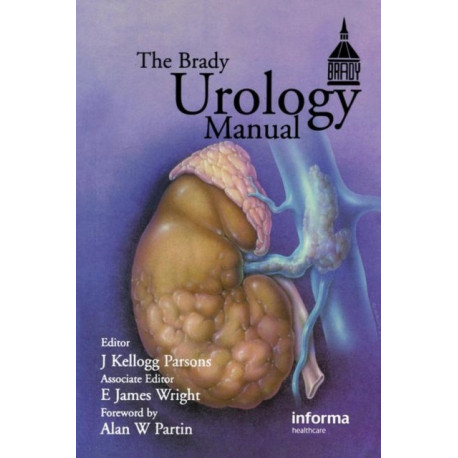 The Brady Urology Manual