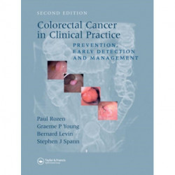 Colorectal Cancer in Clinical Practice: Prevention, Early Detection and Management, Second Edition